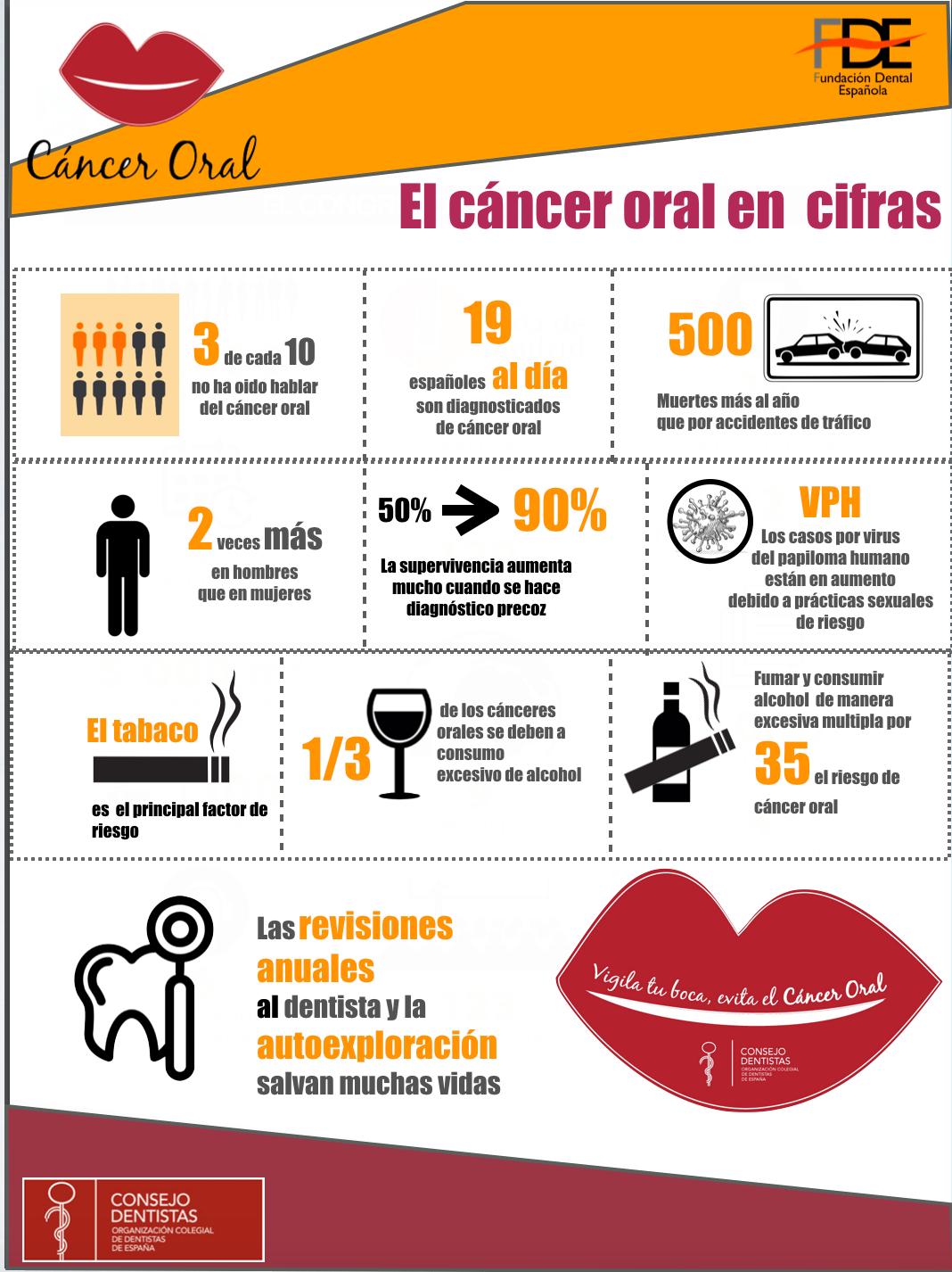 Detección Precoz de Cáncer Oral en Murcia Clínica dental en Murcia