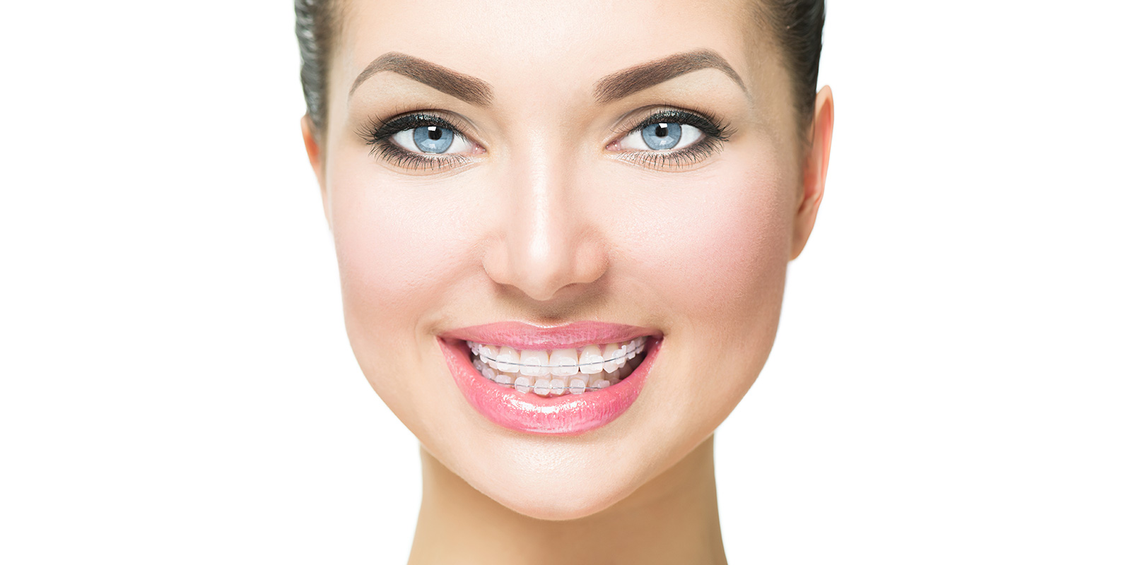 Ortodoncia brackets zafiro en Murcia Precios Clínica Dental Davalos Y