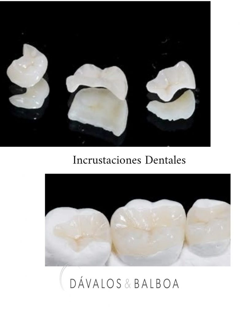 alt+Estética Dental en Murcia