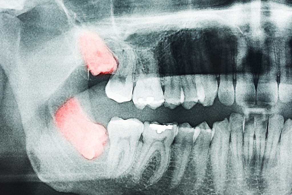 alt+Cirugía Oral en Murcia